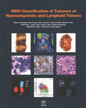WHO Classification of Tumours of Haematopoietic and Lymphoid ...