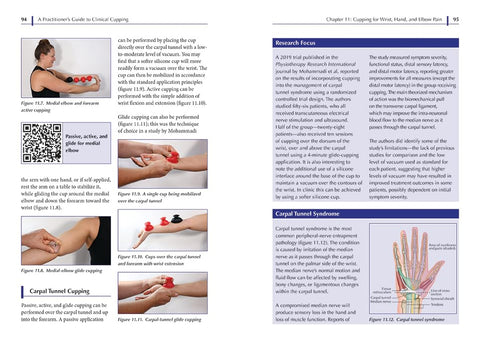 A Practitioner's Guide to Clinical Cupping: Effective Techniques for Pain Management and Injury - MPHOnline.com