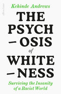 The Psychosis of Whiteness - MPHOnline.com