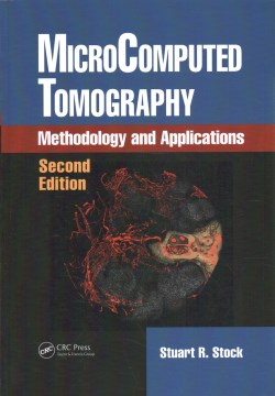 MicroComputed Tomography - MPHOnline.com