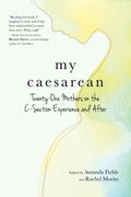 My Caesarean - MPHOnline.com