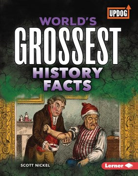 World's Grossest History Facts - MPHOnline.com