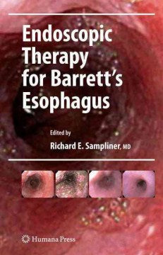 Endoscopic Therapy for Barrett's Esophagus - MPHOnline.com