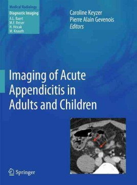 Imaging of Acute Appendicitis in Adults and Children - MPHOnline.com