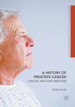 A History of Prostate Cancer - MPHOnline.com