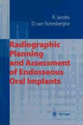 Radiographic Planning and Assessment of Endosseous Oral Implants - MPHOnline.com