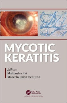 Mycotic Keratitis - MPHOnline.com