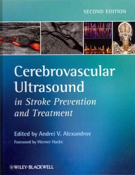 Cerebrovascular Ultrasound in Stroke Prevention and Treatment - MPHOnline.com