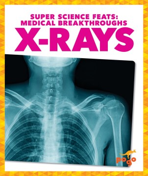 X-Rays - MPHOnline.com