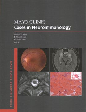 Mayo Clinic Cases in Neuroimmunology - MPHOnline.com