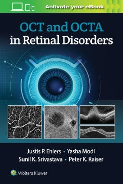 OCT and OCTA in Retinal Disorders - MPHOnline.com