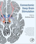 Connectomic Deep Brain Stimulation - MPHOnline.com