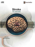 Stroke - MPHOnline.com