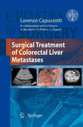 Surgical Treatment of Colorectal Liver Metastases - MPHOnline.com