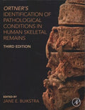 Ortner's Identification of Pathological Conditions in Human Skeletal Remains - MPHOnline.com