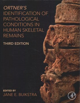 Ortner's Identification of Pathological Conditions in Human Skeletal Remains - MPHOnline.com