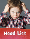 Head Lice - MPHOnline.com