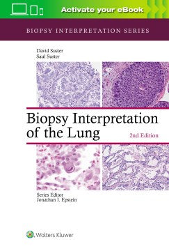 Biopsy Interpretation of the Lung - MPHOnline.com