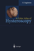 A Color Atlas of Hysteroscopy - MPHOnline.com