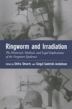 Ringworm and Irradiation - MPHOnline.com