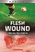 Flesh Wound - MPHOnline.com