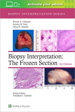 Biopsy Interpretation - MPHOnline.com