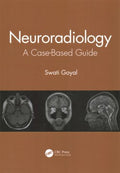 Neuroradiology - MPHOnline.com