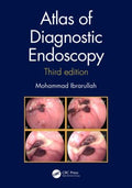 Atlas of Diagnostic Endoscopy - MPHOnline.com