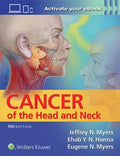 Cancer of the Head and Neck - MPHOnline.com