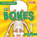 My Bones - MPHOnline.com