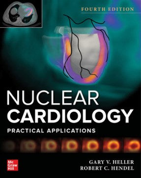 Nuclear Cardiology - MPHOnline.com