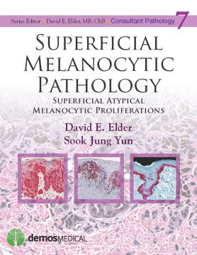 Superficial Melanocytic Pathology - MPHOnline.com