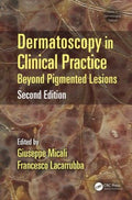 Dermatoscopy in Clinical Practice - MPHOnline.com