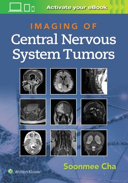 Imaging of Central Nervous System Tumors - MPHOnline.com