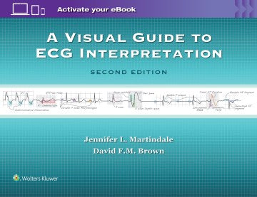 A Visual Guide to ECG Interpretation - MPHOnline.com