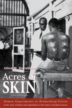 Acres of Skin - MPHOnline.com