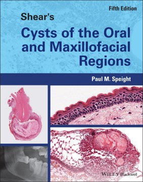 Shear's Cysts of the Oral and Maxillofacial Regions - MPHOnline.com