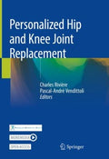 Personalized Hip and Knee Joint Replacement - MPHOnline.com