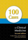 100 CASES IN CLINICAL MEDICINE 2ED - MPHOnline.com