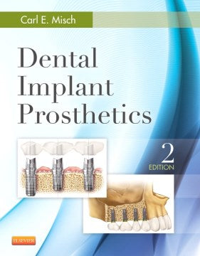 Dental Implant Prosthetics - MPHOnline.com