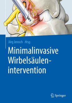 Minimalinvasive Wirbels?ulenintervention - MPHOnline.com