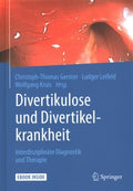 Divertikulose und Divertikelkrankheit + Ebook - MPHOnline.com