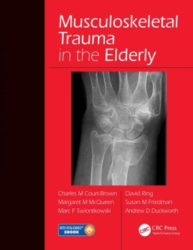 Musculoskeletal Trauma in the Elderly - MPHOnline.com