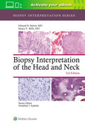 Biopsy Interpretation of the Head and Neck - MPHOnline.com