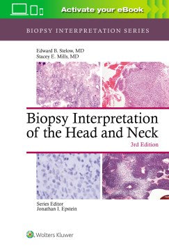 Biopsy Interpretation of the Head and Neck - MPHOnline.com