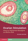 Ovarian Stimulation - MPHOnline.com