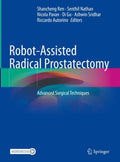 Robot-Assisted Radical Prostatectomy - MPHOnline.com