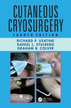 Cutaneous Cryosurgery - MPHOnline.com