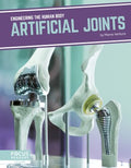 Artificial Joints - MPHOnline.com