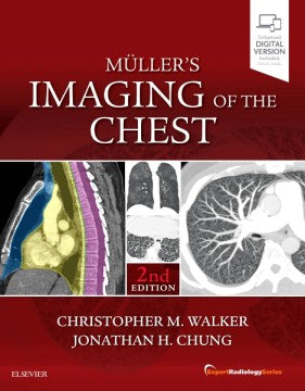 Muller's Imaging of the Chest - MPHOnline.com